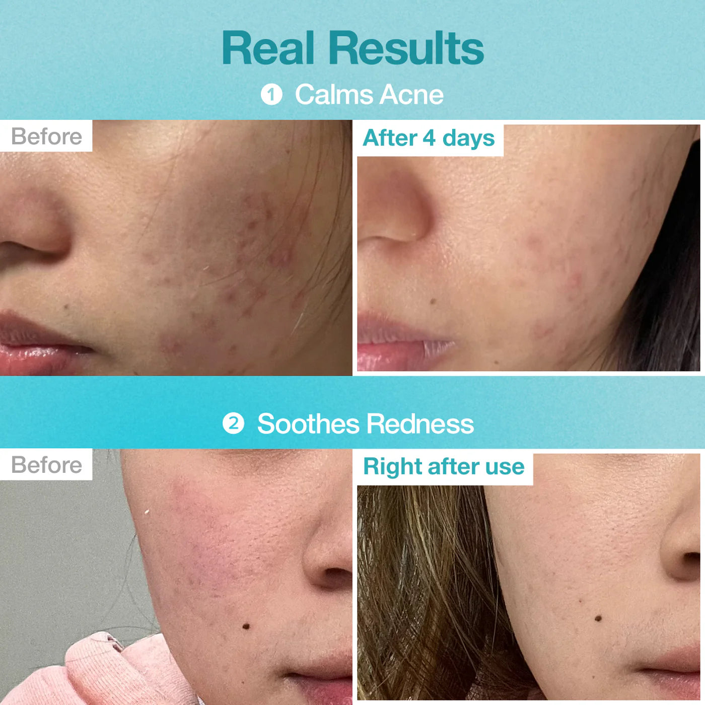 NUMBUZIN : No.1 Pantothenic B5 Hyaluronic Active Clear Mask