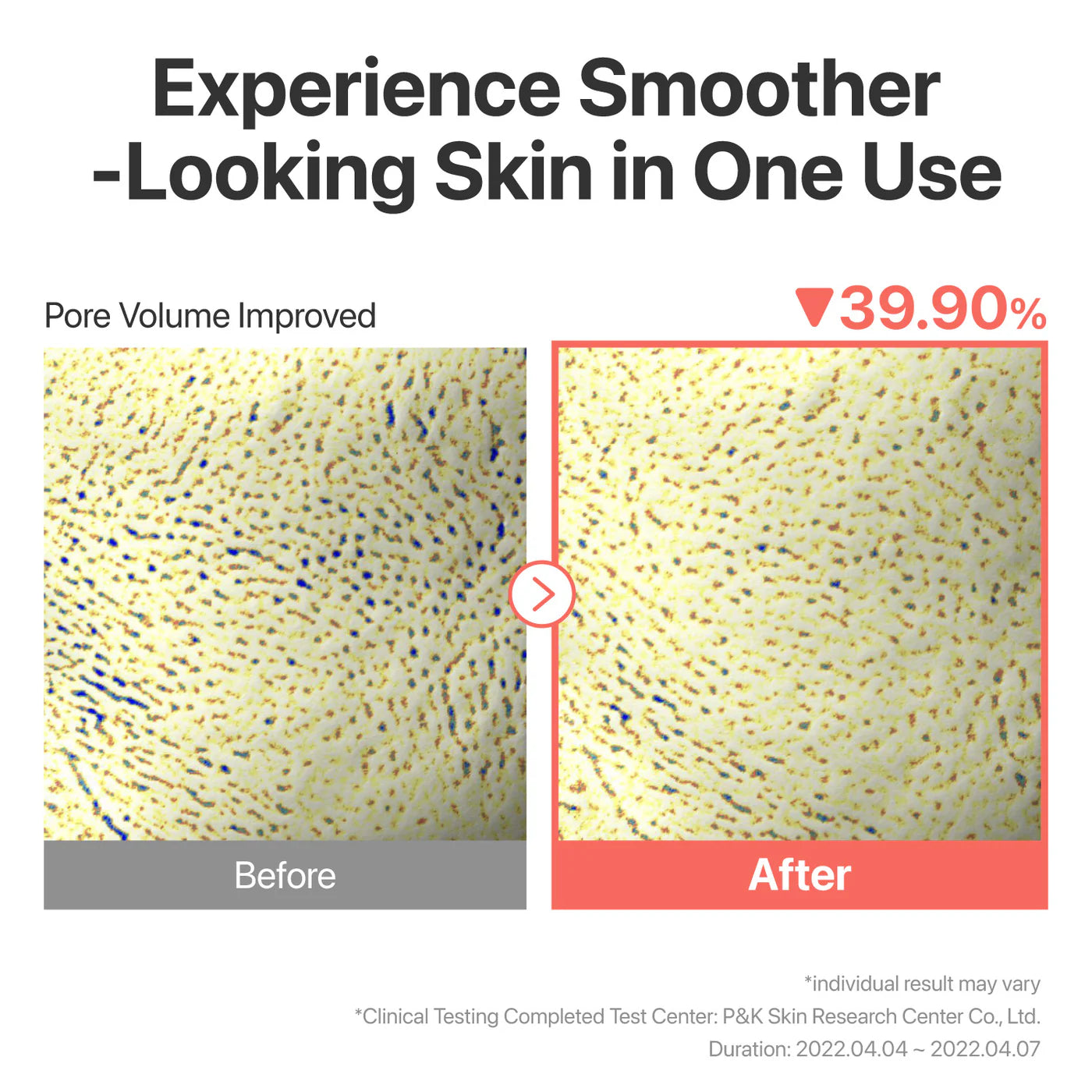 NUMBUZIN : No.3 Tingle-Pore Softening Sheet Mask