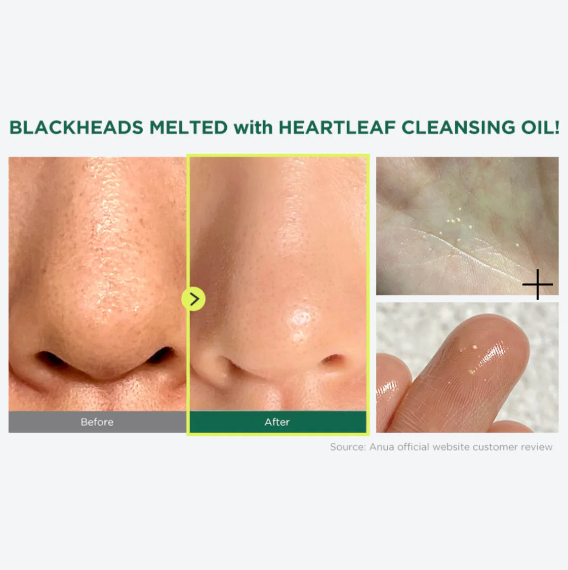ANUA Heartleaf Pore Control Cleansing Oil