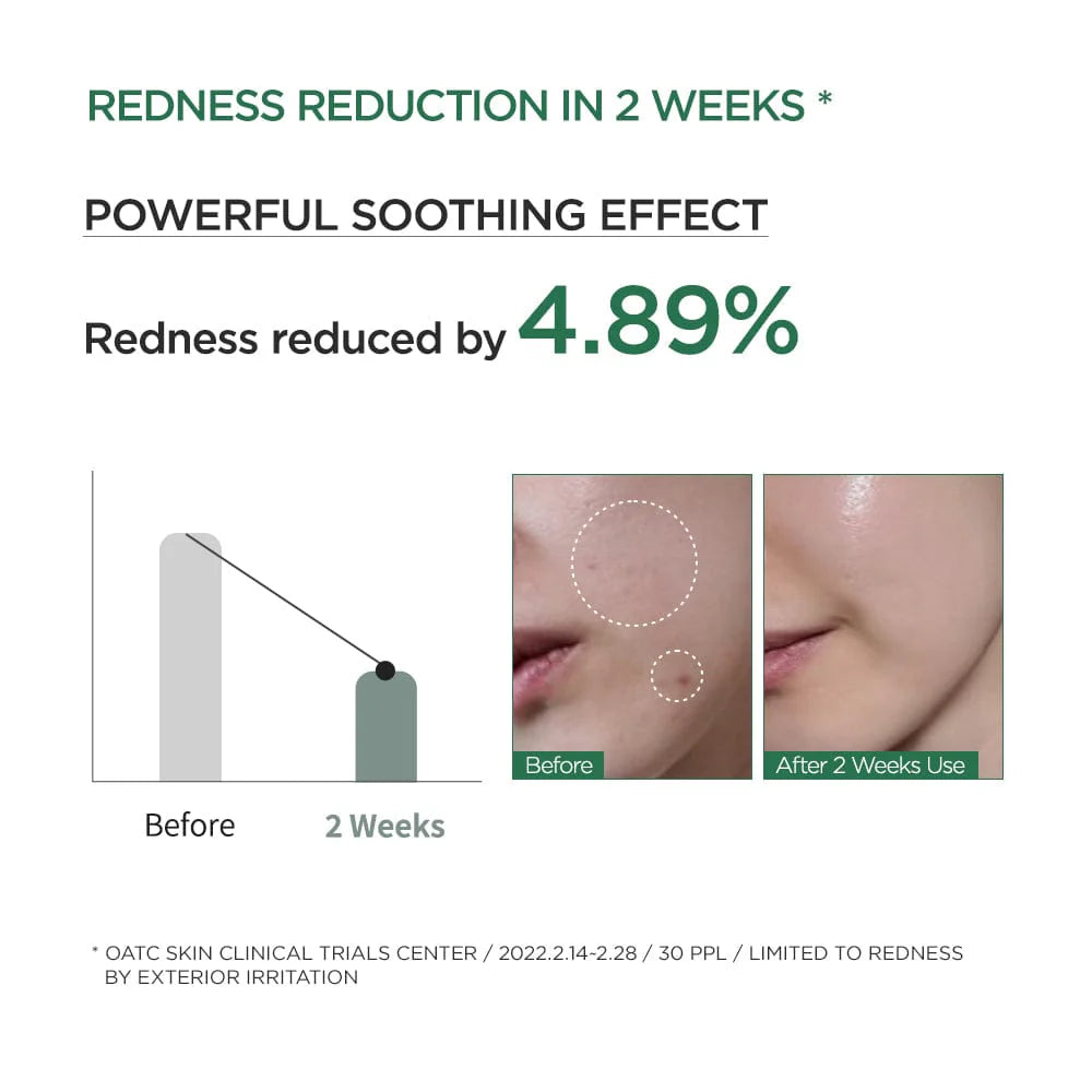 ANUA : Heartleaf 80% Moisture Soothing Ampoule